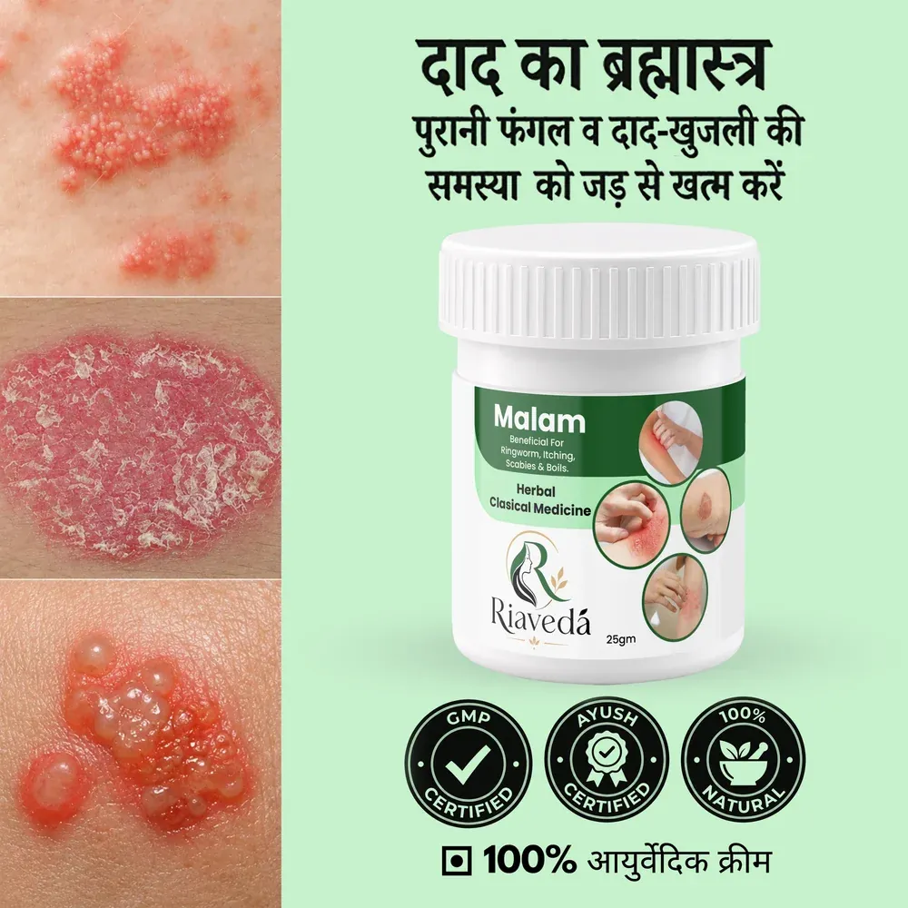 Riaveda Herbal Malam – targeted relief for ringworm, itching, and boils